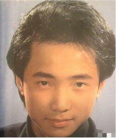 娱乐圈脱发明星,脱发背后的故事与挑战